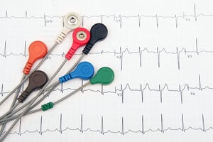 ECG and Mortality